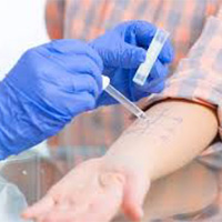Allergy Testing